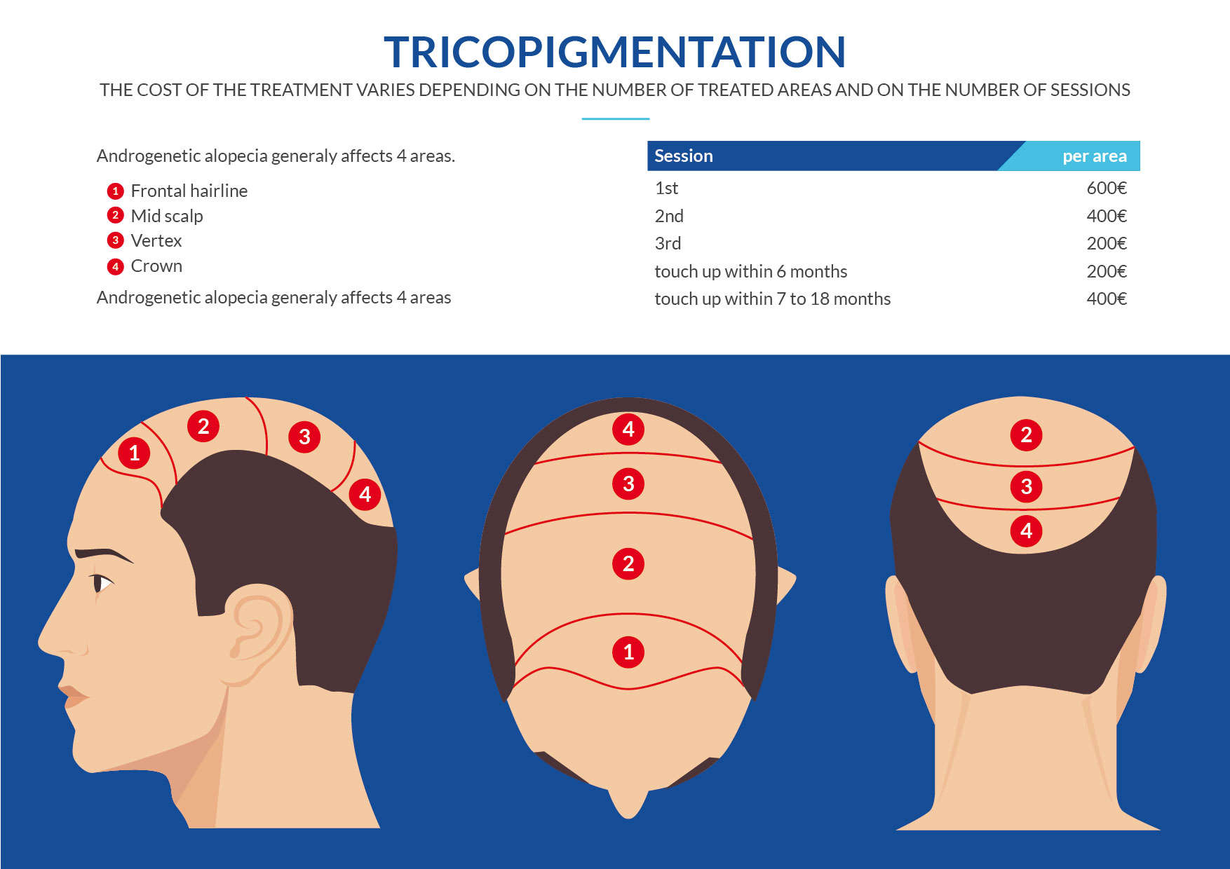 tricopigmentation 01